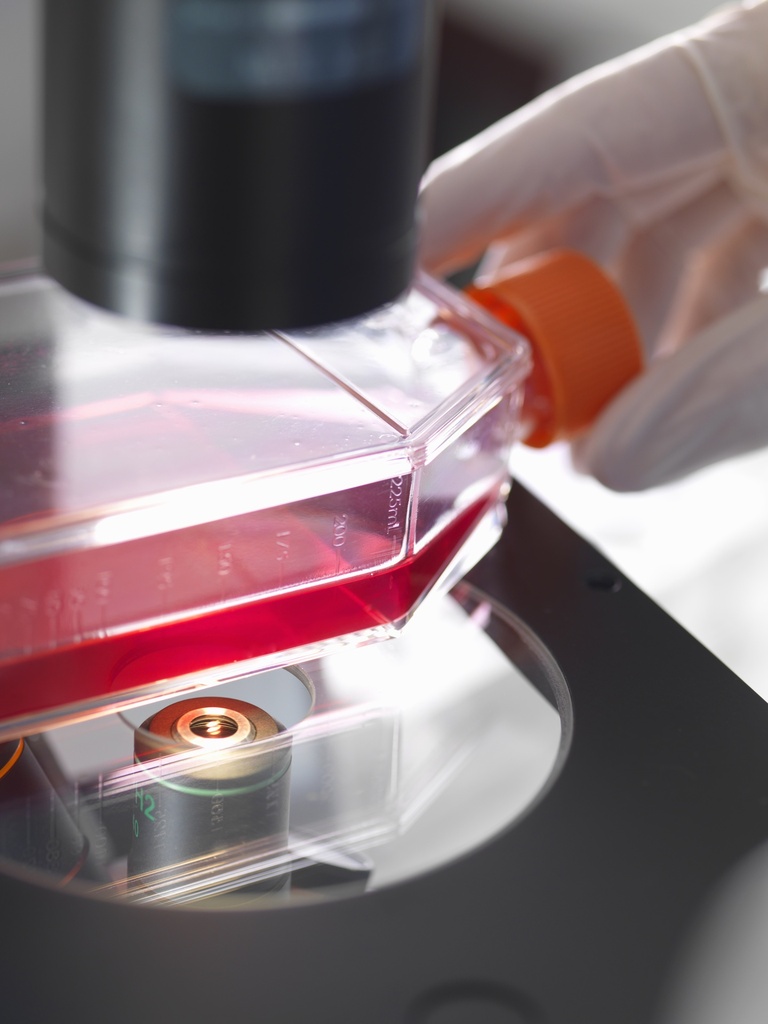 Claudin18.2 (CLDN18.2) HEK293 Cell Line